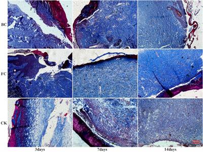 Effects and metabolism of fish collagen sponge in repairing acute wounds of rat skin